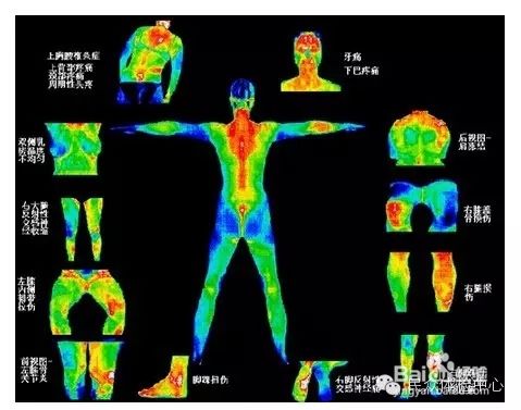 【中国联通】在全国提供5G+热成像人体测温方案防控疫情